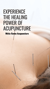 Best Acupuncture Treatment in Encinitas