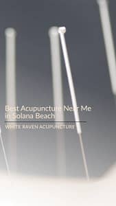 best acupuncture near me in solana beach