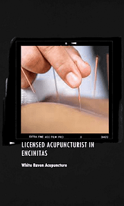 Experienced and Best Licensed Acupuncturist in Encinitas