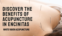 acupuncture in encinitas