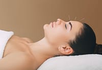 acupuncture techniques for headache relief