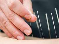 acupuncture for breast health