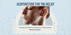 acupuncture for tmj in solana beach
