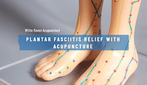 get plantar fasciitis relief with acupuncture