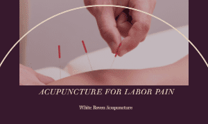acupuncture for labor pain