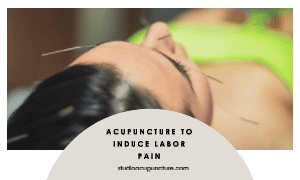 acupuncture to induce labor pain