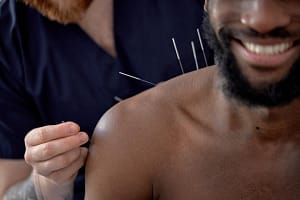 acupuncture practitioner session