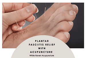 plantar fasciitis relief with acupuncture