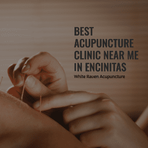 best acupuncture clinic near you in encinitas 
